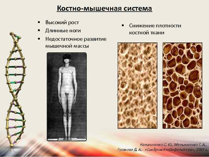 Костно-мышечная система § Высокий рост § Длинные ноги § Недостаточное развитие мышечной массы §