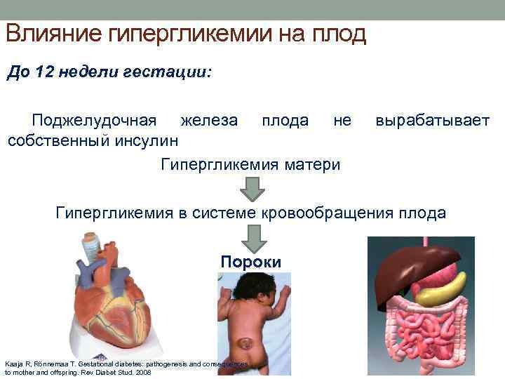 Влияние гипергликемии на плод До 12 недели гестации: Поджелудочная железа плода не собственный инсулин