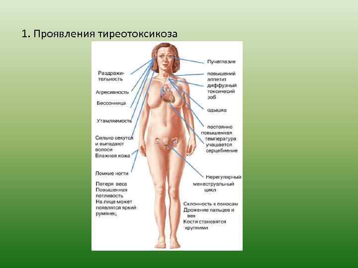 1. Проявления тиреотоксикоза 