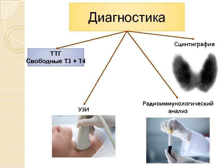 Диффузный токсический зоб у детей фото