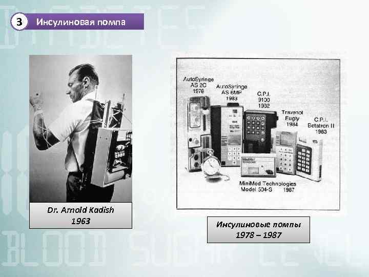3 Инсулиновая помпа Dr. Arnold Kadish 1963 Инсулиновые помпы 1978 – 1987 