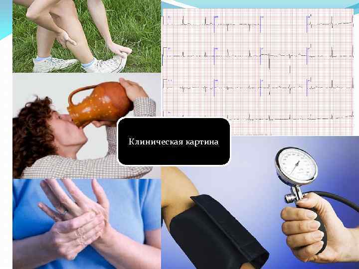 Клиническая картина 