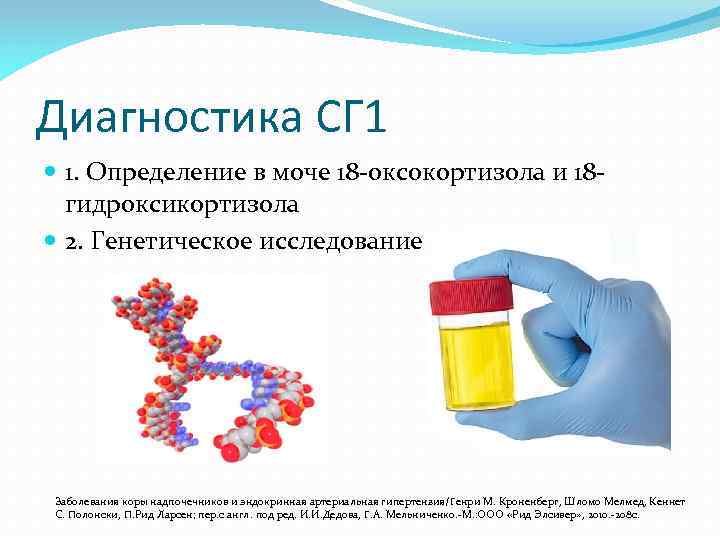 Диагностика СГ 1 1. Определение в моче 18 -оксокортизола и 18 гидроксикортизола 2. Генетическое