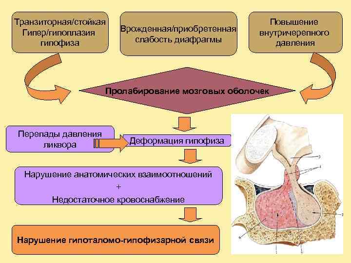 Реферат: «Пустое» турецкое седло: этиология, патогенез, нейроэндокринные и зрительные нарушения