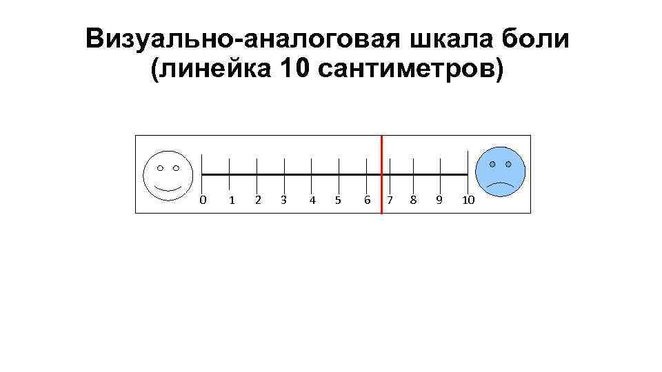 Визуально-аналоговая шкала боли (линейка 10 сантиметров) 0 1 2 3 4 5 6 7