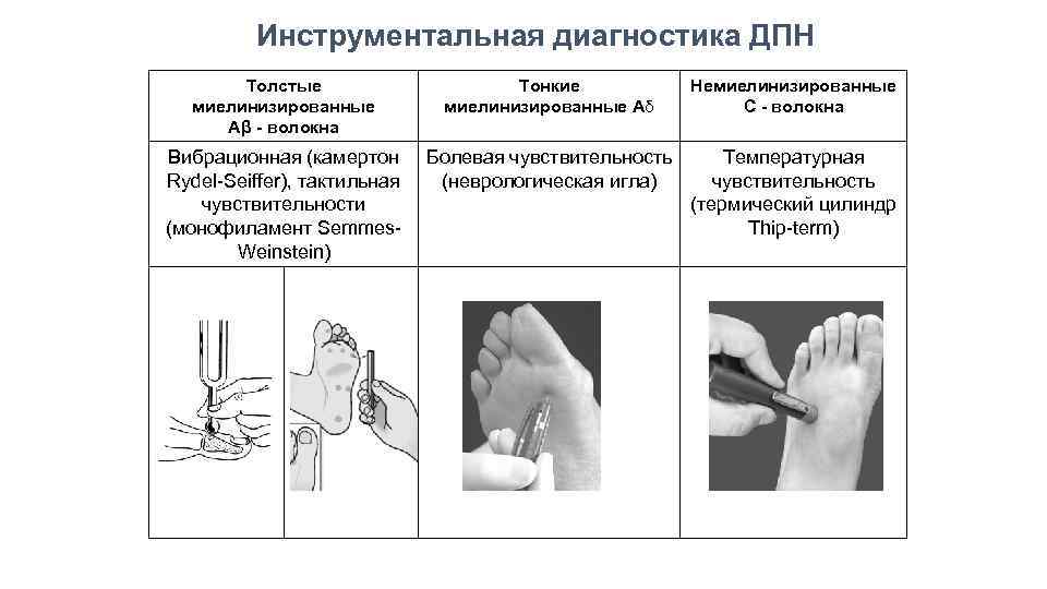 Алкогольная нейропатия карта вызова