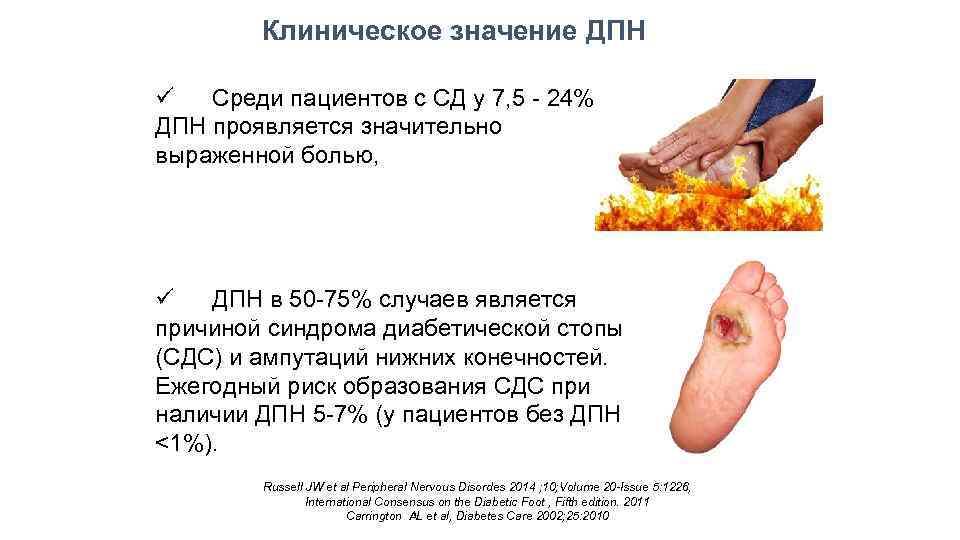 Клиническое значение ДПН ü Среди пациентов с СД у 7, 5 - 24% ДПН