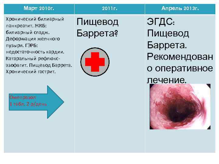 Март 2010 г. Хронический билиарный панкреатит. ЖКБ: билиарный сладж. Деформация желчного пузыря. ГЭРБ: недостаточность