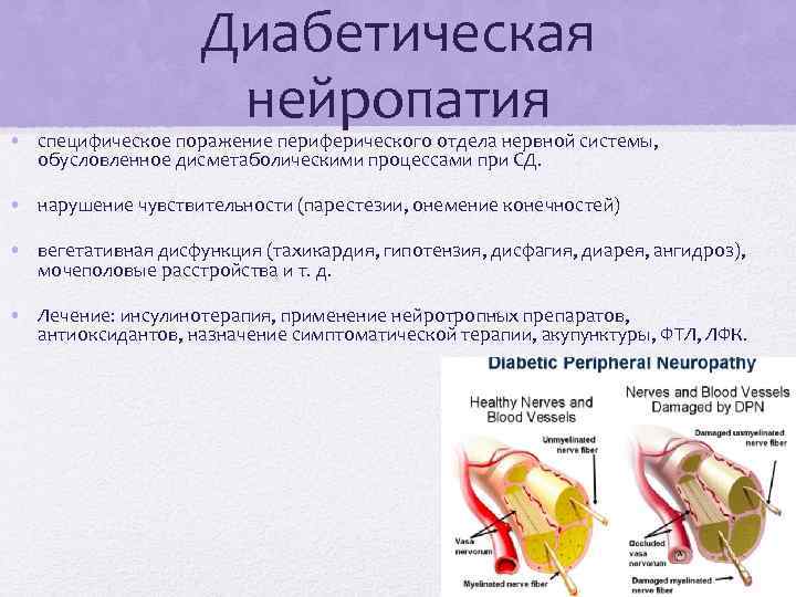 Нейропатия диабетического типа
