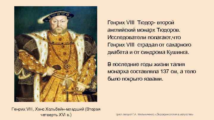 Генрих VIII Тюдор- второй английский монарх Тюдоров. Исследователи полагают, что Генрих VIII страдал от