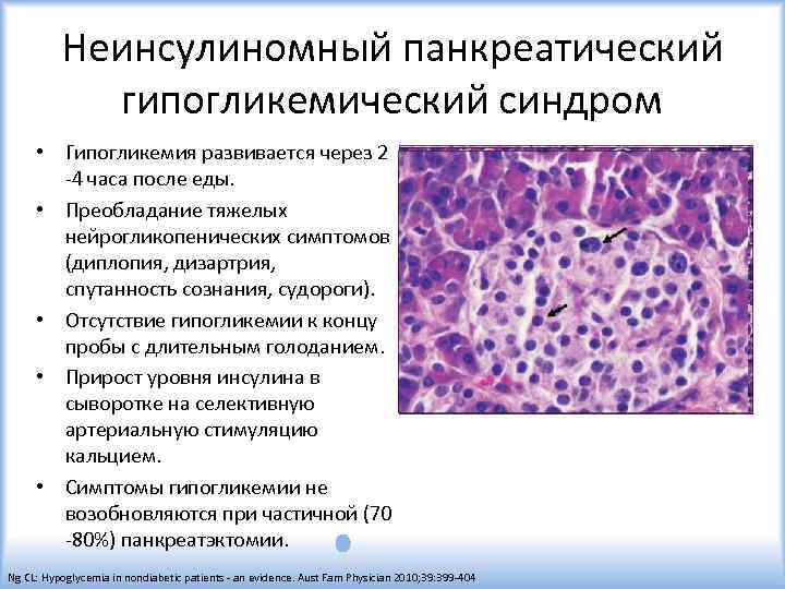 Неинсулиномный панкреатический гипогликемический синдром • Гипогликемия развивается через 2 -4 часа после еды. •