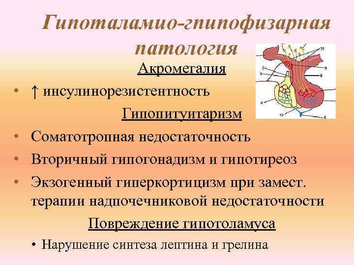 Гипоталамио-гпипофизарная патология • • Акромегалия ↑ инсулинорезистентность Гипопитуитаризм Соматотропная недостаточность Вторичный гипогонадизм и гипотиреоз