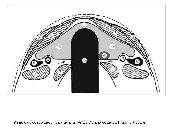 Ультразвуковое исследование щитовидной железы. Атлас-руководство. Эпштейн. Матящук 