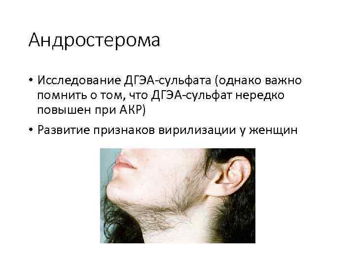 Андростерома • Исследование ДГЭА-сульфата (однако важно помнить о том, что ДГЭА-сульфат нередко повышен при