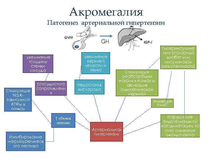 Акромегалия Патогенез артериальной гипертензии GH увеличения верхней челюсти и языка увеличение толщины стенки сосуда