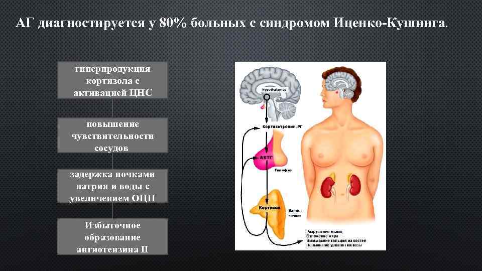 АГ диагностируется у 80% больных с синдромом Иценко-Кушинга. гиперпродукция кортизола с активацией ЦНС повышение