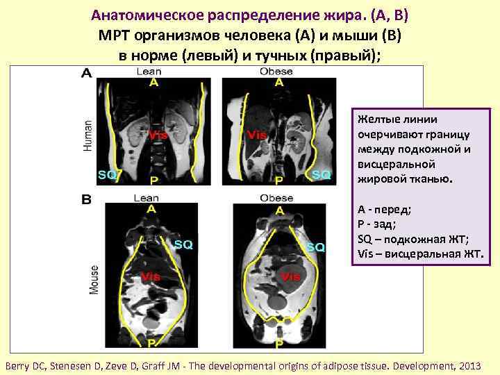 Анатомическое распределение жира. (A, B) МРТ организмов человека (A) и мыши (B) в норме