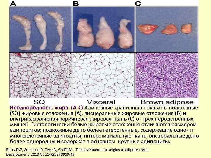 Неоднородность жира. (A-C) Адипозные хранилища показаны подкожные (SQ) жировые отложения (A), висцеральные жировые отложения