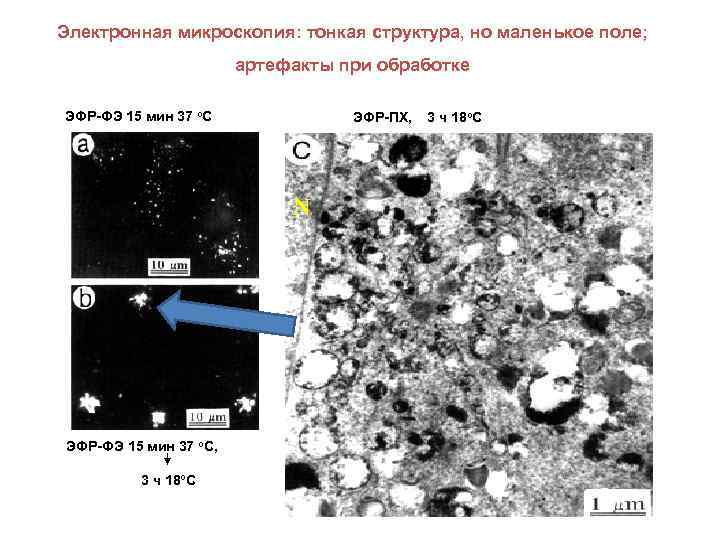 Электронная микроскопия: тонкая структура, но маленькое поле; артефакты при обработке ЭФР-ФЭ 15 мин 37