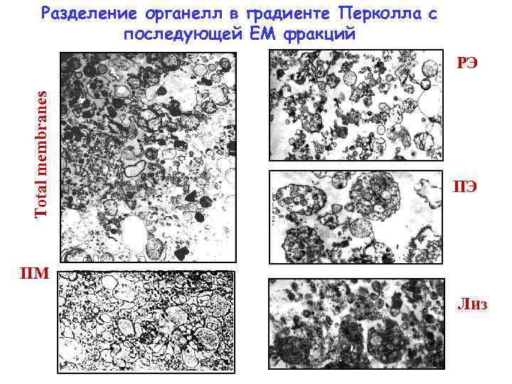 Разделение органелл в градиенте Перколла с последующей ЕМ фракций Total membranes РЭ ПЭ ПМ