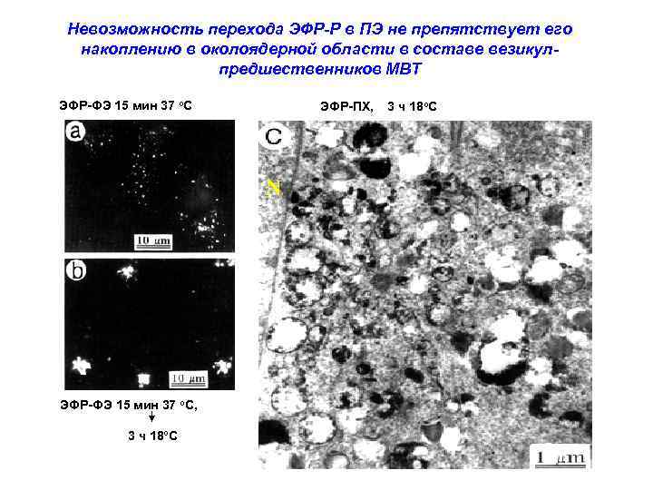 Невозможность перехода ЭФР-Р в ПЭ не препятствует его накоплению в околоядерной области в составе