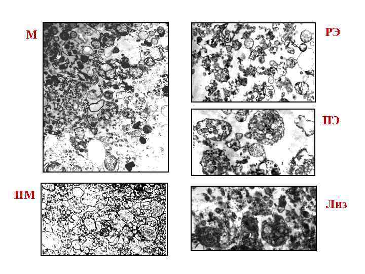 М РЭ ПЭ ПМ Лиз 