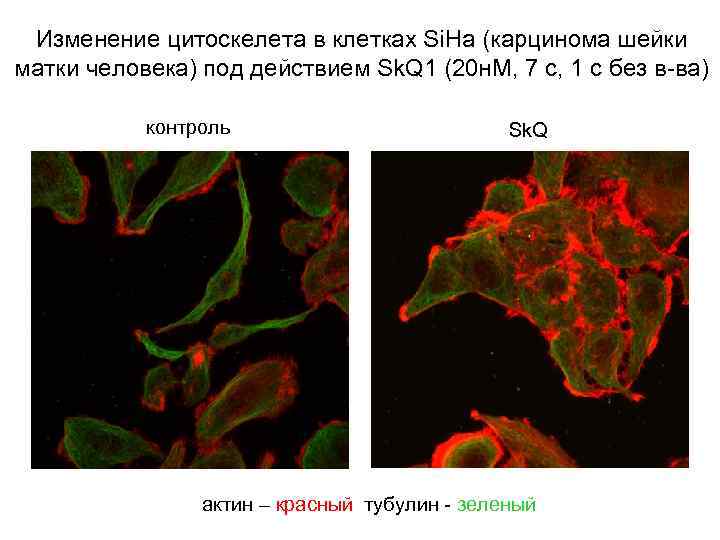 Изменение цитоскелета в клетках Si. Ha (карцинома шейки матки человека) под действием Sk. Q