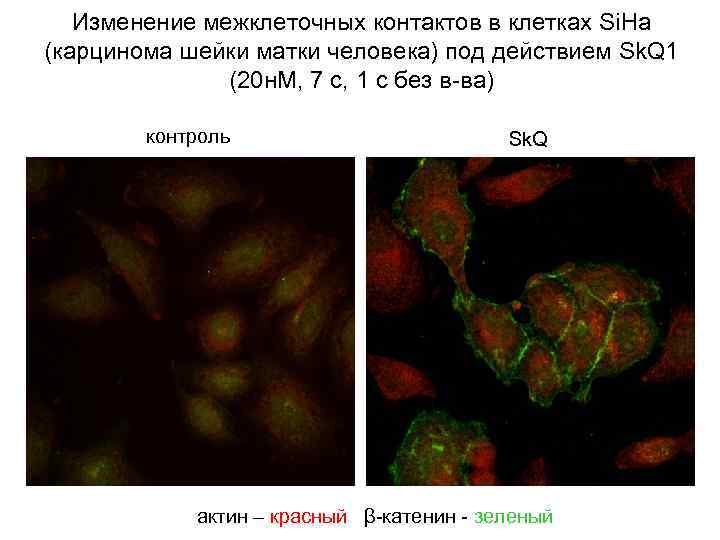 Изменение межклеточных контактов в клетках Si. Ha (карцинома шейки матки человека) под действием Sk.