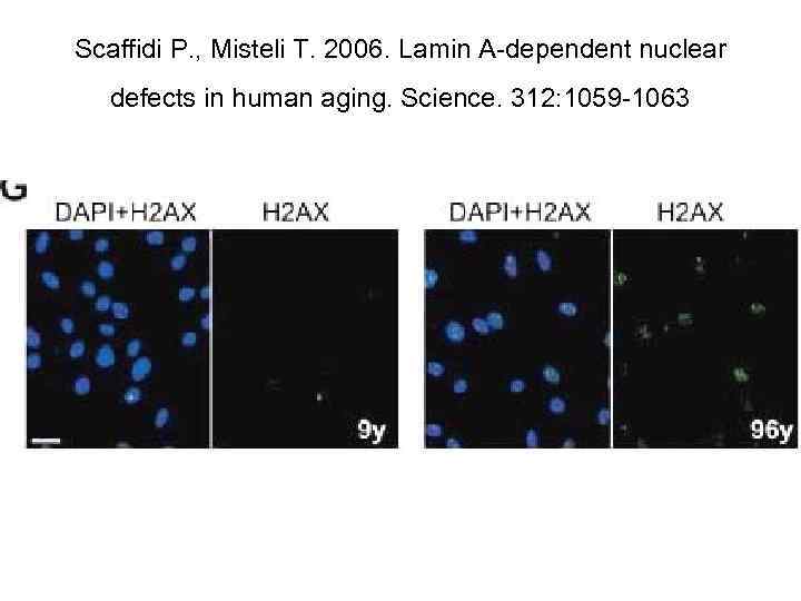 Scaffidi P. , Misteli T. 2006. Lamin A-dependent nuclear defects in human aging. Science.