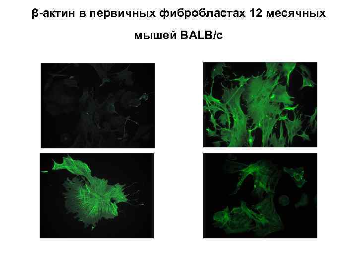 β-актин в первичных фибробластах 12 месячных мышей BALB/c 