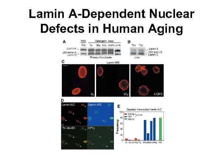 Lamin A-Dependent Nuclear Defects in Human Aging 