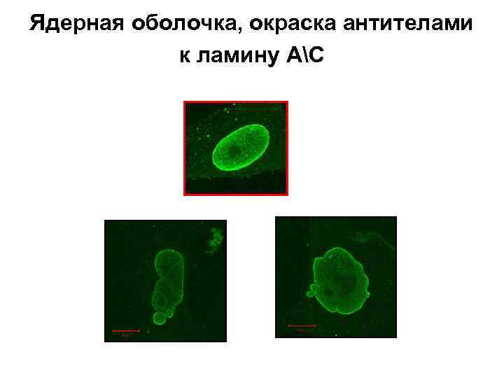 Ядерная оболочка, окраска антителами к ламину АС 