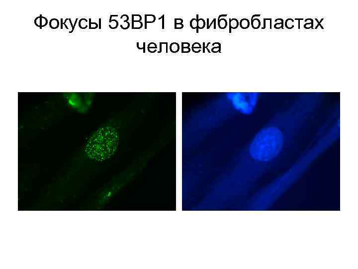 Фокусы 53 BP 1 в фибробластах человека 