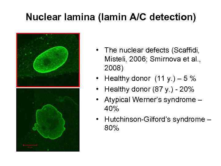 Nuclear lamina (lamin A/C detection) • The nuclear defects (Scaffidi, Misteli, 2006; Smirnova et