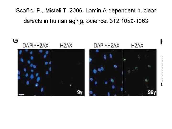 Scaffidi P. , Misteli T. 2006. Lamin A-dependent nuclear defects in human aging. Science.