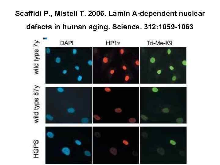 Scaffidi P. , Misteli T. 2006. Lamin A-dependent nuclear defects in human aging. Science.