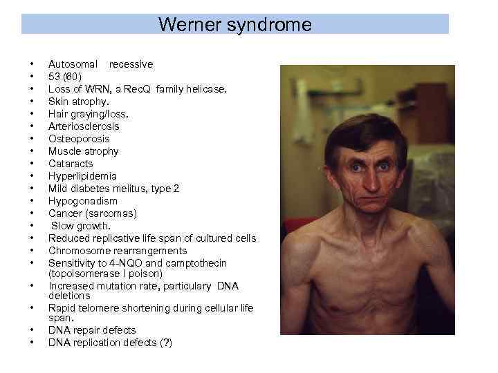 Werner syndrome • • • • • • Autosomal recessive 53 (60) Loss of