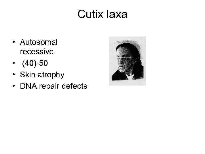 Cutix laxa • Autosomal recessive • (40)-50 • Skin atrophy • DNA repair defects