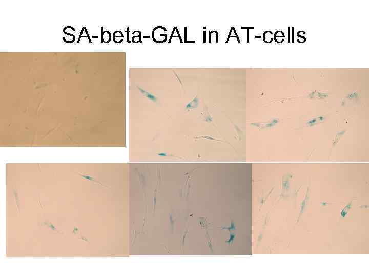 SA-beta-GAL in AT-cells 