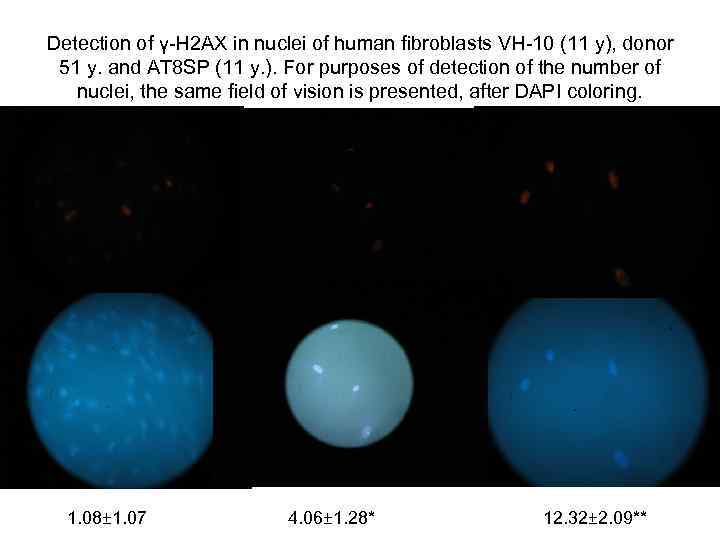 Detection of γ-Н 2 АХ in nuclei of human fibroblasts VH-10 (11 y), donor