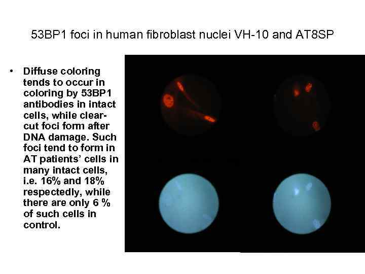 53 ВР 1 foci in human fibroblast nuclei VH-10 and АТ 8 SP •