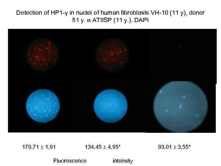 Detection of НР 1 -γ in nuclei of human fibroblasts VH-10 (11 y), donor