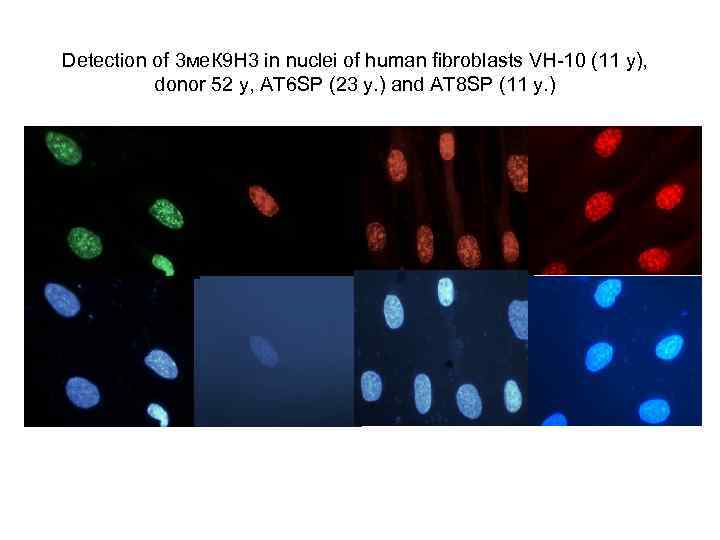 Detection of 3 ме. К 9 Н 3 in nuclei of human fibroblasts VH-10