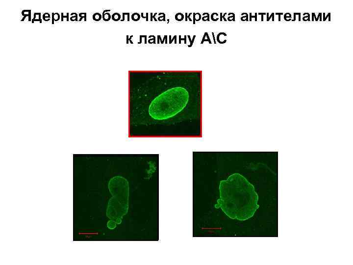 Ядерная оболочка, окраска антителами к ламину АС 