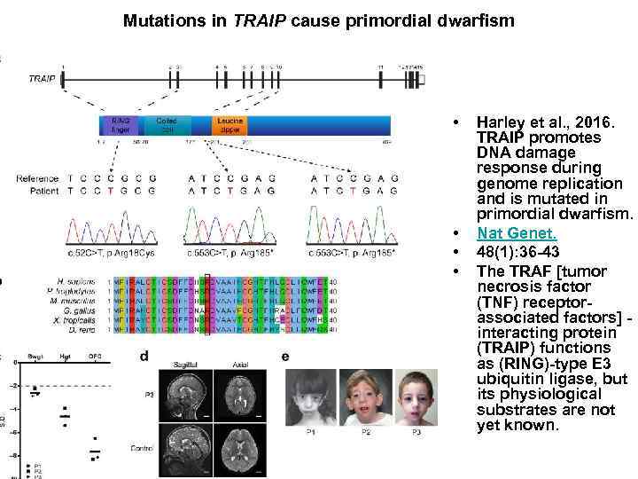 Mutations in TRAIP cause primordial dwarfism • • Harley et al. , 2016. TRAIP