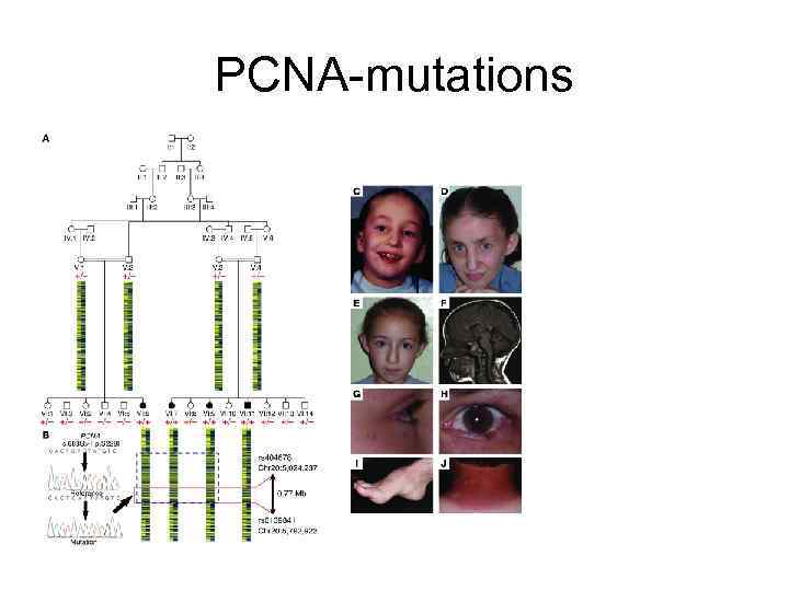 PCNA-mutations 