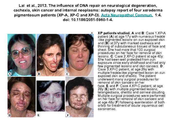 Lai et al. , 2013. The influence of DNA repair on neurological degeneration, cachexia,