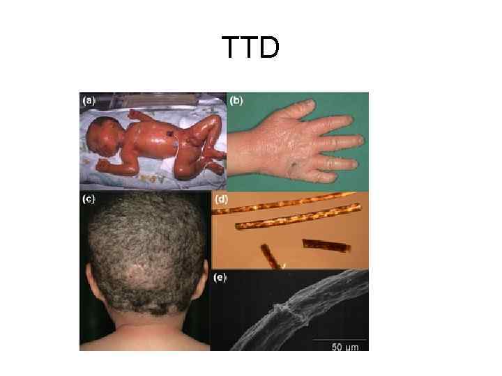 TTD 