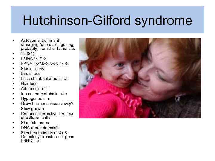 Hutchinson-Gilford syndrome • • • • Autosomal dominant, emerging “de novo”, getting, probably, from