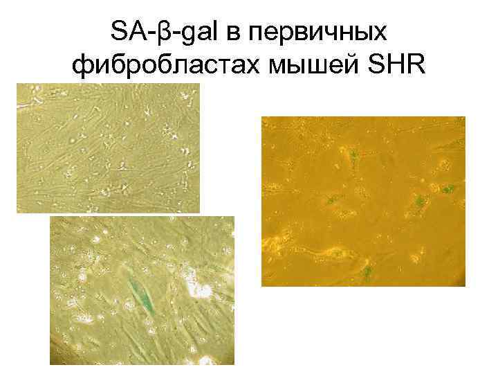 SA-β-gal в первичных фибробластах мышей SHR 